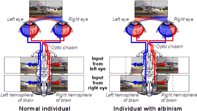 Visual pathways in an albino